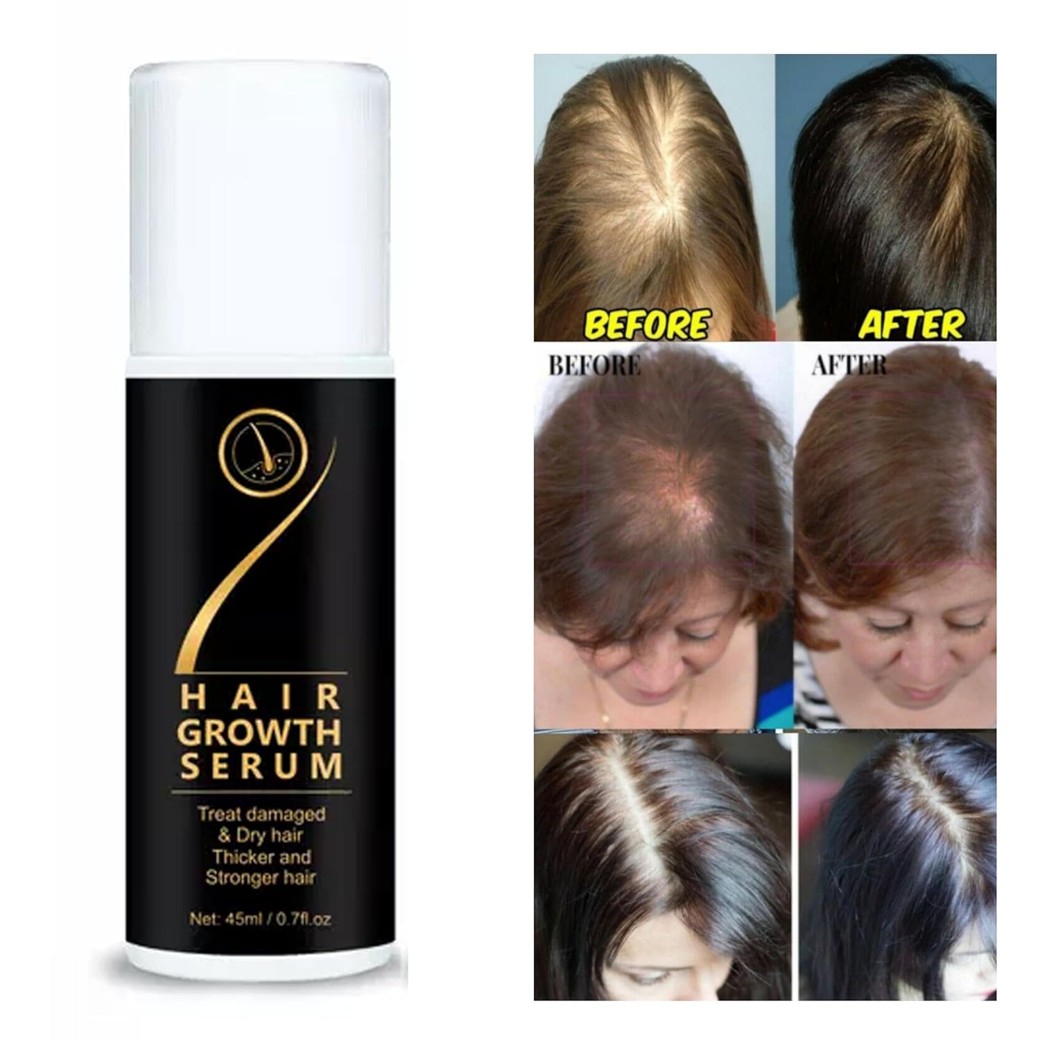 ViralZone™ Hair Growth Serum (Pack of 2)